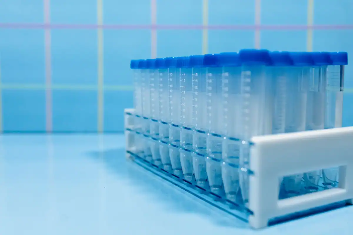 Eprubete de laborator într-un suport, folosite la testul ADN de paternitate